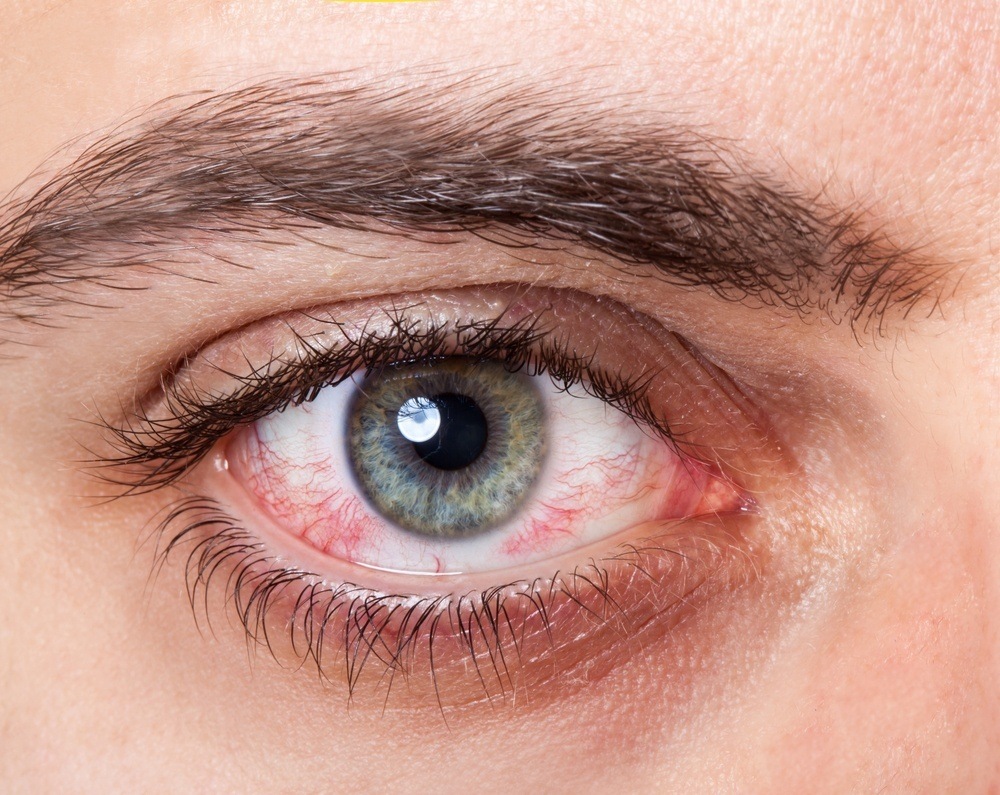 Eye Problems? Here's What It Says About Your Health 3