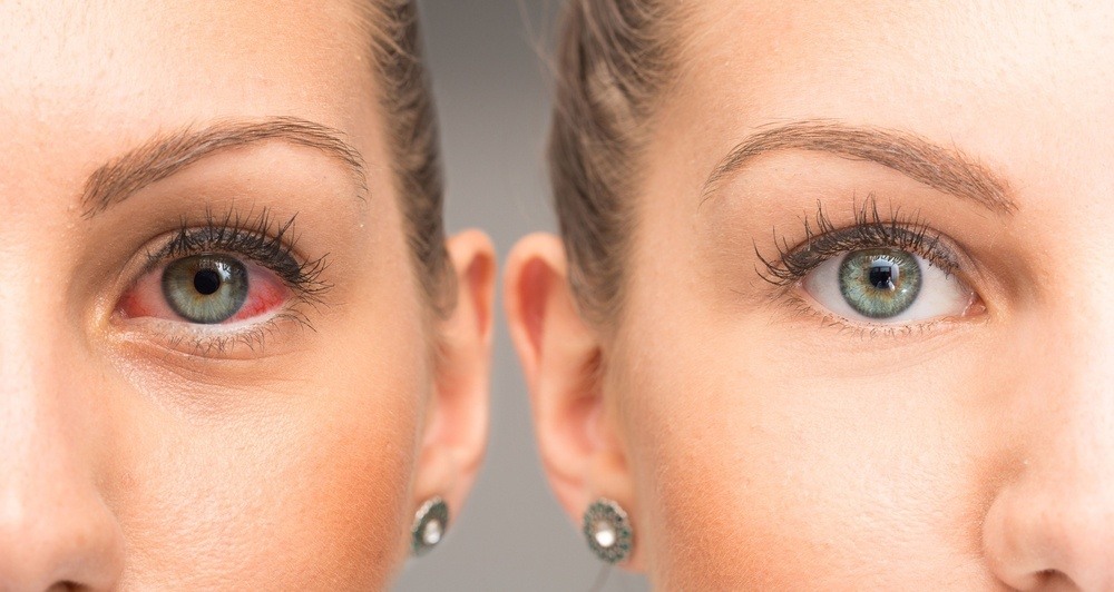 Eye Problems? Here's What It Says About Your Health 1