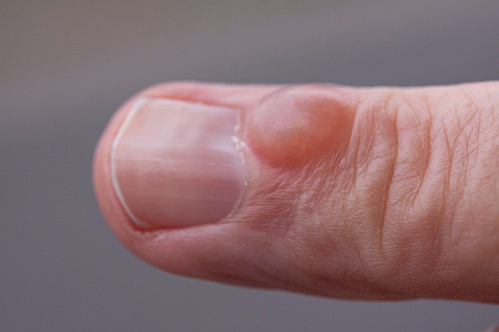 9 Serious Health Problems Your Nails Might Warn You About 1