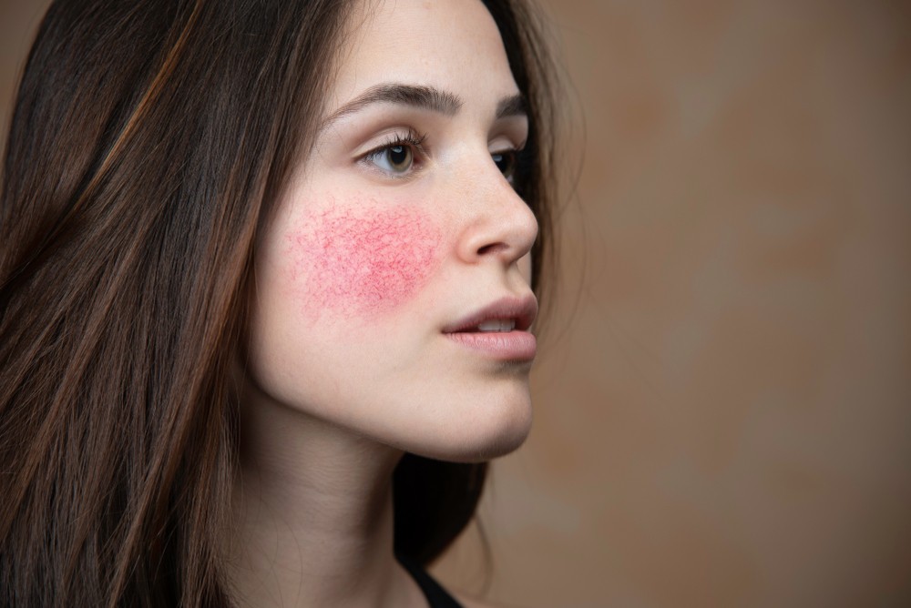 Noticed Any Bumps on Your Face? They May Signal These 5 Health Problems 6