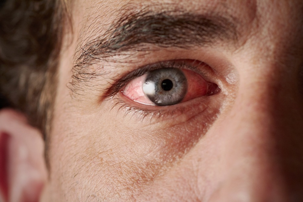 9 Strange Eye Symptoms You Should NEVER Ignore After 50 1